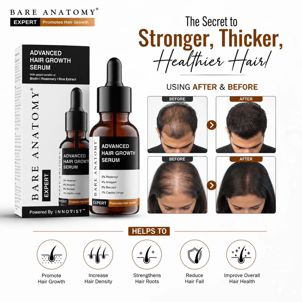 Bare Anatomy Advanced Hair Growth Serum (30ml) - Image 4